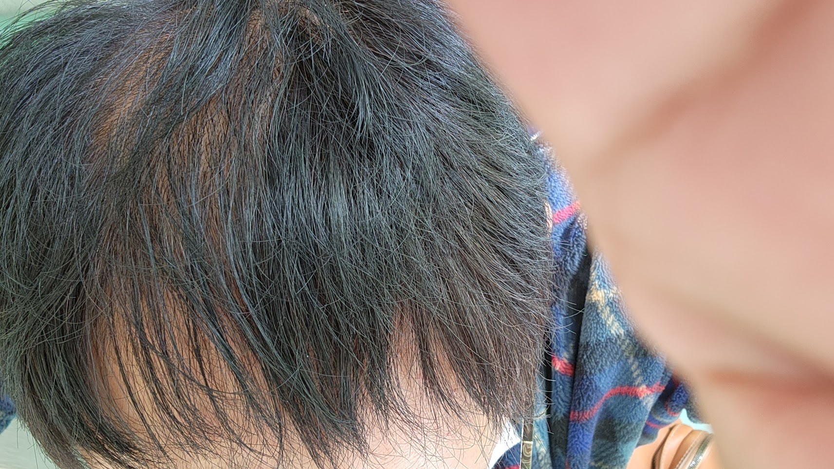 https://www.smile0136.com/blog/%E6%AF%9B%E6%9F%93%E3%82%81.jpg