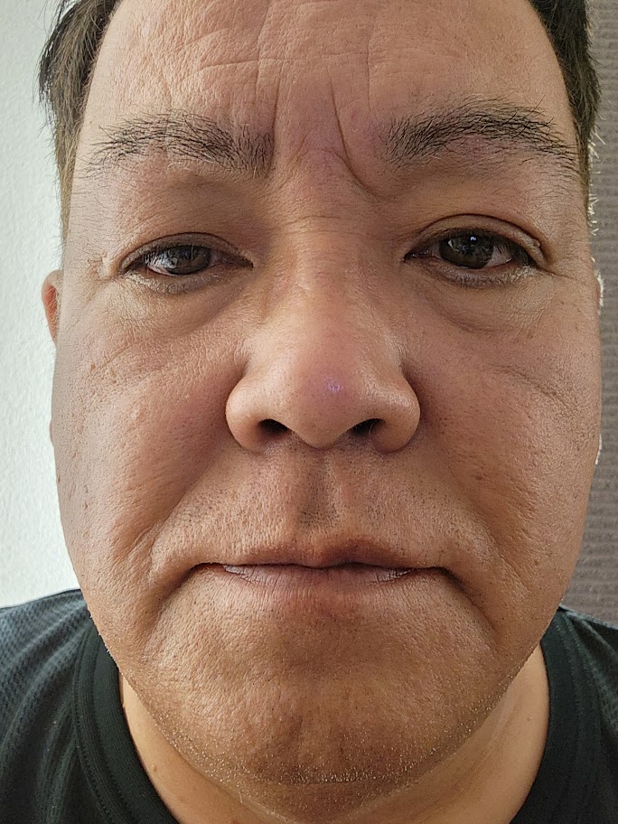 https://www.smile0136.com/blog/%E7%99%BE%E5%90%88%E5%AD%90%E4%BC%BC.jpg
